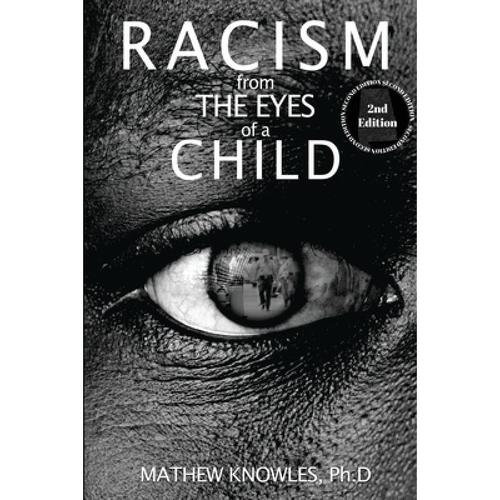 Racism From the Eyes of a Child高清完整免费手机播放